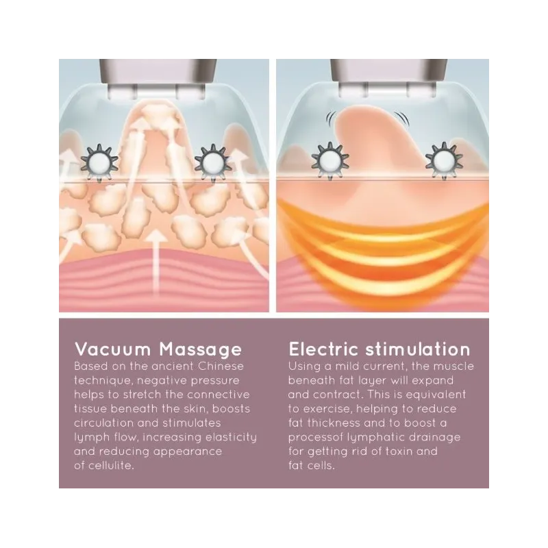 Homedics CELL-500-EU Smoothee Anti Cellulite Vacuum Massage Skin Smoother