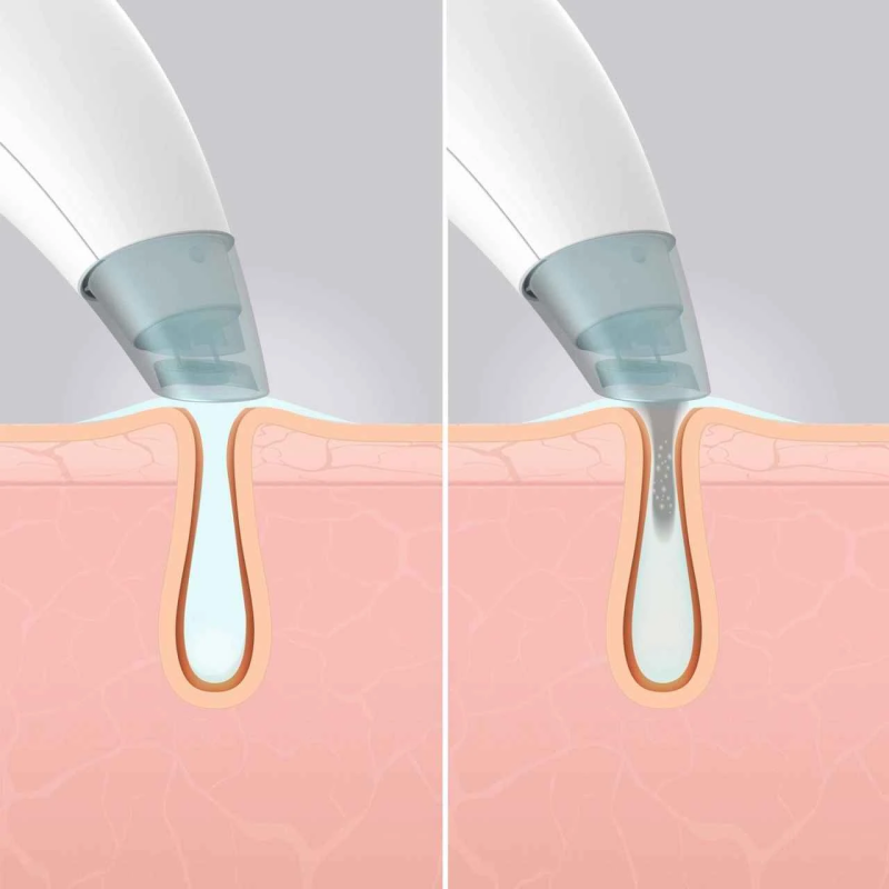 Homedics FAC-HY100 Refresh Hydra Facial